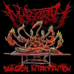 Morgroth - Surgical Intervention