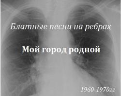 Сборник - Блатные песни на ребрах - Мой город родной